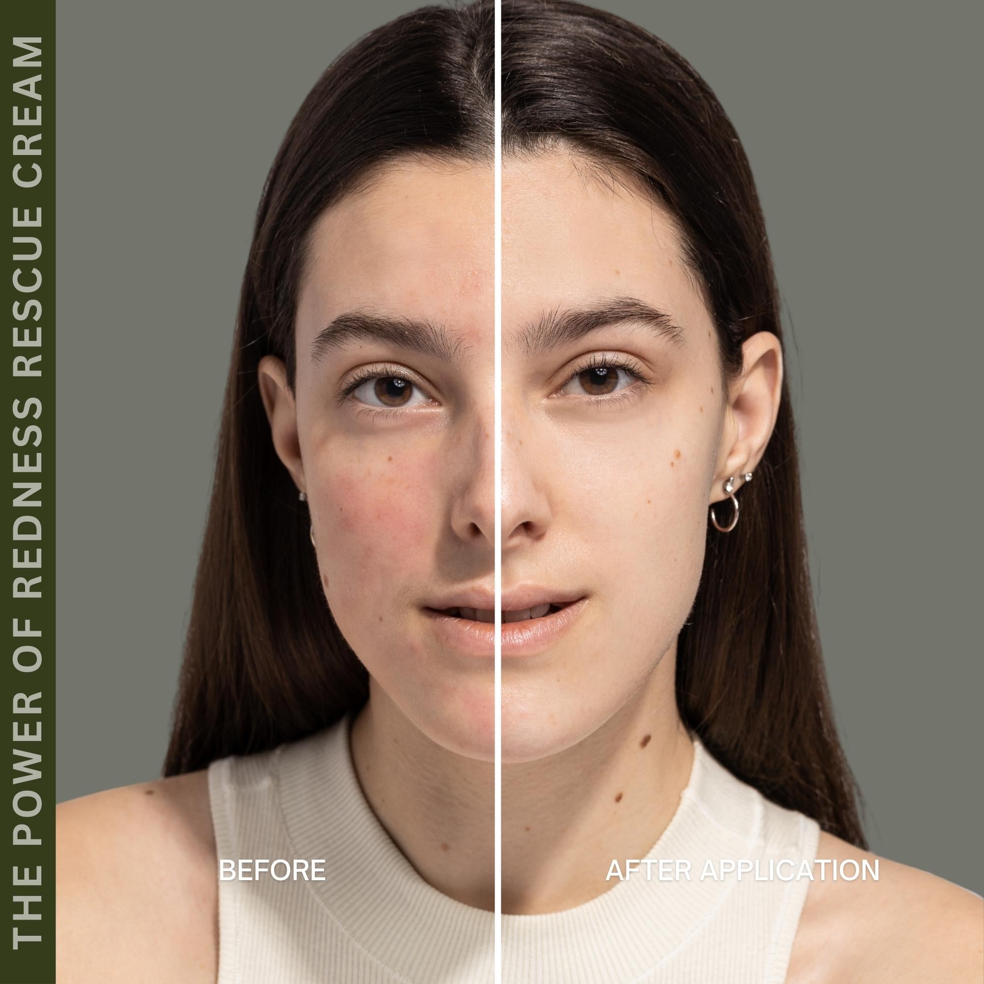 Redness Rescue Cream (RRC)