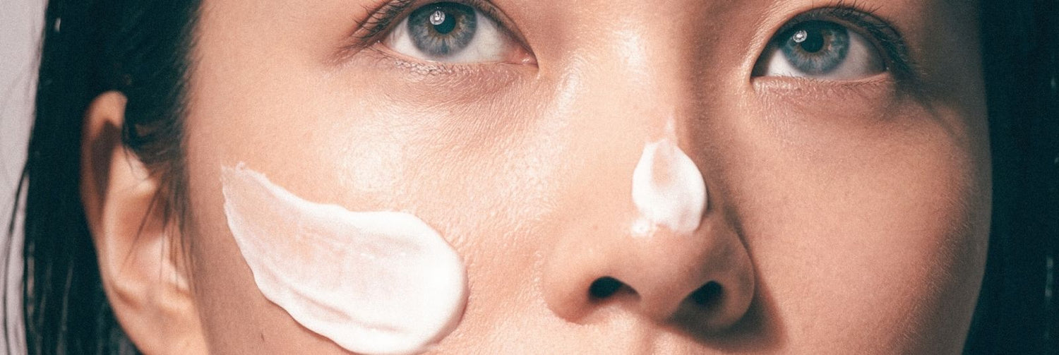 4 Natural Products to Treat and Prevent Breakouts